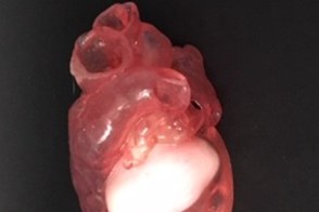 3D printed model of a heart